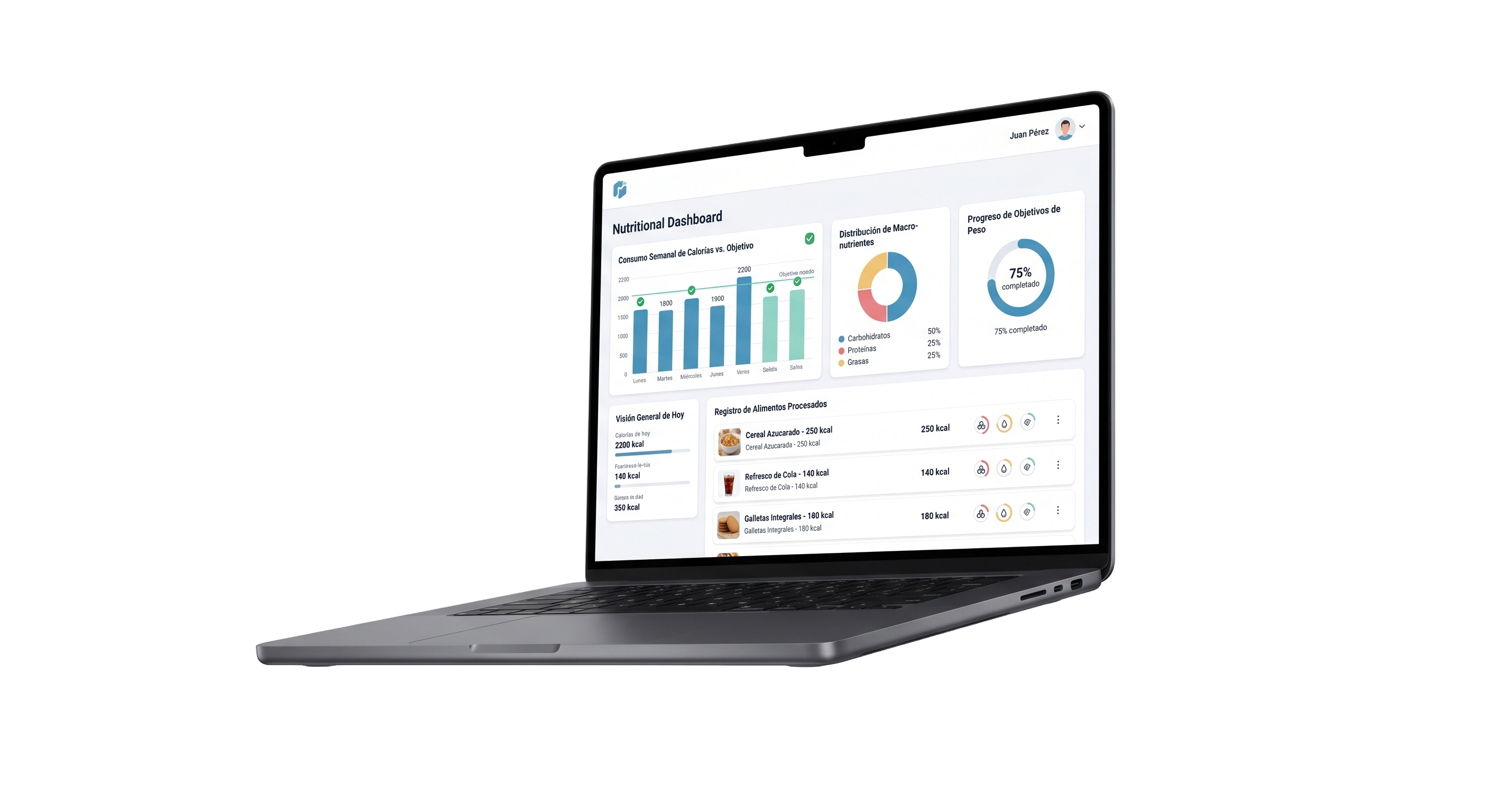 Dashboard de Vitals IA en MacBook